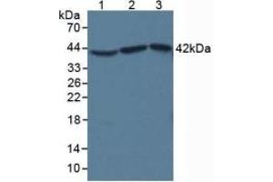 SDS-PAGE of Protein Standard from the Kit (Highly purified E. (beta Actin ELISA 试剂盒)
