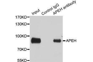 Immunoprecipitation analysis of 100ug extracts of SW480 cells using 3ug APEH antibody. (APEH 抗体)