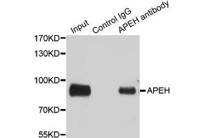 Immunoprecipitation analysis of 100ug extracts of SW480 cells using 3ug APEH antibody. (APEH 抗体)