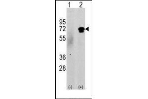 Western blot analysis of CAMKK2 (arrow) using rabbit polyclonal CAMKK2 Antibody (CAMKK2 抗体  (N-Term))