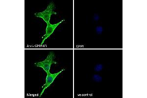 (ABIN768598) Immunofluorescence analysis of paraformaldehyde fixed A431 cells, permeabilized with 0. (GPR183 抗体  (Internal Region))