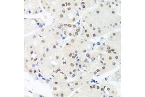 Immunohistochemistry of paraffin-embedded human stomach using HMGN1 antibody (ABIN5975005) at dilution of 1/100 (40x lens).