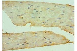 Immunohistochemistry of paraffin-embedded human skeletal muscle tissue using ABIN7149059 at dilution of 1:100 (KAT14 抗体  (AA 523-782))