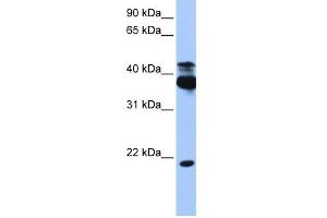 WB Suggested Anti-STK38 Antibody Titration:  0. (STK38 抗体  (C-Term))