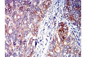Immunohistochemistry (IHC) image for anti-Sialic Acid Binding Ig-Like Lectin 6 (SIGLEC6) (AA 27-347) antibody (ABIN7193247)