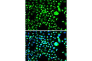 Immunofluorescence analysis of MCF7 cell using SMCHD1 antibody. (SMCHD1 抗体)