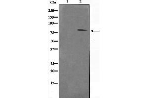 Western blot analysis of STAT1 phosphorylation expression in MCF7 whole cell lysates,The lane on the left is treated with the antigen-specific peptide.