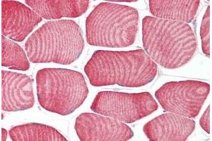 Human Skeletal Muscle: Formalin-Fixed, Paraffin-Embedded (FFPE) (FBXO32 抗体  (C-Term))