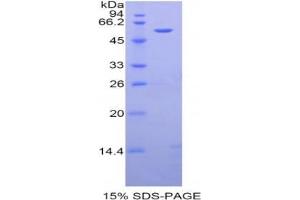 SDS-PAGE analysis of Rat Angiotensinogen Protein. (AGT 蛋白)