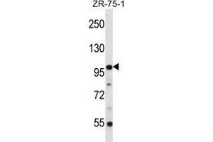 ZNF845 Antibody (N-term) western blot analysis in ZR-75-1 cell line lysates (35 µg/lane).