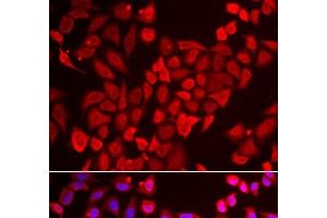 Immunofluorescence analysis of U2OS cells using TNP2 Polyclonal Antibody