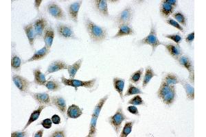 Anti- PARK7 Picoband antibody,ICC ICC: A549 Cell (PARK7/DJ1 抗体  (AA 2-189))