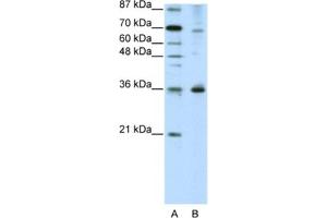 Western Blotting (WB) image for anti-Forkhead Box Q1 (FOXQ1) antibody (ABIN2461965) (FOXQ1 抗体)