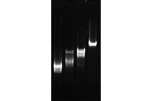 Polymerase Chain Reaction (PCR) image for Sjogren Syndrome Antigen B (SSB) (Active) protein (ABIN2452175)