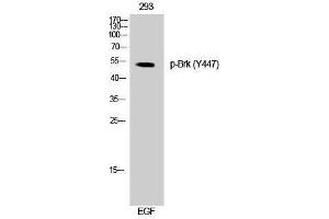 Western Blotting (WB) image for anti-PTK6 Protein tyrosine Kinase 6 (PTK6) (pTyr447) antibody (ABIN3173172) (PTK6 抗体  (pTyr447))