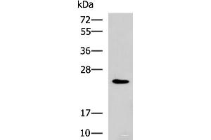 Western blot analysis of NIH/3T3 cell lysate using RAB38 Polyclonal Antibody at dilution of 1:900 (RAB38 抗体)