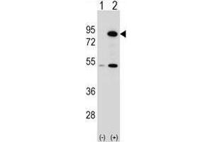 Western blot analysis of THOC1 (arrow) using rabbit polyclonal THOC1 Antibody (C-term) . (THOC1 抗体  (C-Term))