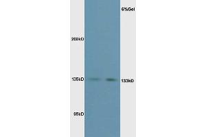 L1 mouse liver lysate L2 mouse kidney lysates probed with Rabbit Anti-Phospho-eNOS (Thr495) Polyclonal Antibody, Unconjugated  at 1:3000 for 90 min at 37˚C. (ENOS 抗体  (pThr495))