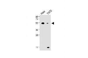 All lanes : Anti-B4GalT1 Antibody (C-term) at 1:1000 dilution Lane 1: Hela, whole cell lysate Lane 2: T47D whole cell lysate ysates/proteins at 20 μg per lane. (B4GALT1 抗体  (C-Term))