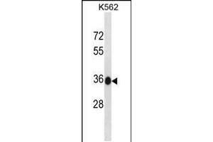 Western blot analysis in K562 cell line lysates (35ug/lane). (MMACHC 抗体  (C-Term))