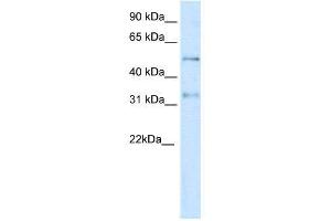WB Suggested Anti-KCNAB2  Antibody Titration: 0. (KCNAB2 抗体  (Middle Region))
