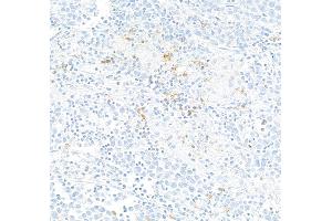 Immunohistochemistry (IHC) image for anti-Tumor Necrosis Factor Receptor Superfamily, Member 18 (TNFRSF18) (AA 191-241) antibody (ABIN7455202)