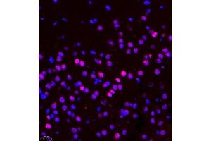 Immunofluorescence of paraffin embedded rat brain using CDY1 (ABIN7073493) at dilution of 1:400 (400x lens) (CDY1 抗体)