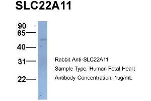 Host:  Rabbit  Target Name:  SLC22A11  Sample Type:  Human Fetal Heart  Antibody Dilution:  1. (SLC22A11 抗体  (C-Term))