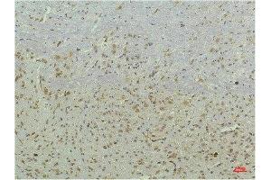 Immunohistochemical analysis of paraffin-embedded Mouse Brain Tissue using PPAR Delta Mouse mAb diluted at 1:200. (PPARD 抗体)