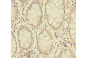 Immunohistochemistry (IHC) image for anti-Solute Carrier Family 39 (Zinc Transporter), Member 7 (SLC39A7) (AA 235-380) antibody (ABIN7176692)