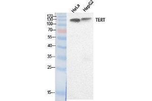Western Blotting (WB) image for anti-Telomerase Reverse Transcriptase (TERT) (Internal Region) antibody (ABIN3181058) (TERT 抗体  (Internal Region))