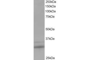 ABIN185205 staining (1 ug/ml) of Human Lung lysate (RIPA buffer, 35 ug total protein per lane). (HIV-1 Tat Interactive Protein 2, 30kDa (HTATIP2) (N-Term) 抗体)