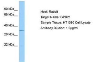 Image no. 1 for anti-G Protein-Coupled Receptor 21 (GPR21) (AA 197-246) antibody (ABIN6750101) (GPR21 抗体  (AA 197-246))