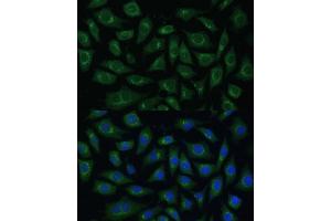 Immunofluorescence analysis of L929 cells using  Polyclonal Antibody (ABIN7265476) at dilution of 1:100 (40x lens). (ARL1 抗体  (AA 62-181))