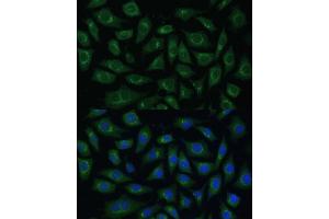 Immunofluorescence analysis of L929 cells using  Polyclonal Antibody (ABIN7265476) at dilution of 1:100 (40x lens). (ARL1 抗体  (AA 62-181))