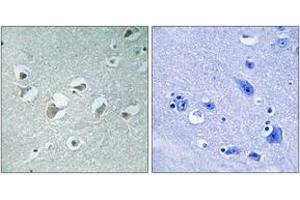 Immunohistochemistry analysis of paraffin-embedded human brain, using MLK1/2 (Phospho-Thr312/266) Antibody. (MLK1/2 抗体  (pThr312))