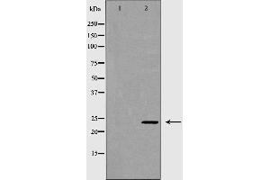 Western blot analysis of K562 cell lysate, using RAB27A Antibody. (RAB27A 抗体  (C-Term))