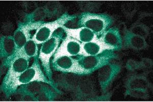 Immunofluorescence staining of HeLa cells (Human cervical epitheloid carcinoma, ATCC CCL-2. (BUB1B 抗体  (AA 276-388))