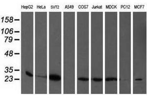 Image no. 2 for anti-phosphoglycerate Mutase 2 (Muscle) (PGAM2) antibody (ABIN1500171) (PGAM2 抗体)