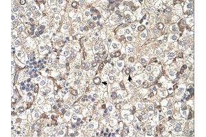 ST3GAL4 antibody was used for immunohistochemistry at a concentration of 4-8 ug/ml. (ST3GAL4 抗体  (Middle Region))