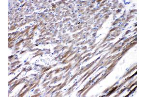 IHC analysis of CHRNA5 using anti-CHRNA5 antibody .