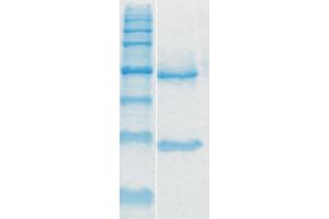 Image no. 1 for anti-Toxin A antibody (ABIN335169) (Toxin A 抗体)