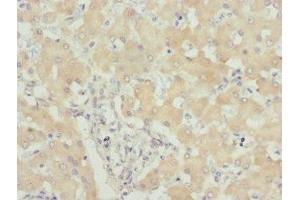 Immunohistochemistry of paraffin-embedded human liver tissue using ABIN7174300 at dilution of 1:100 (USP26 抗体  (AA 664-913))