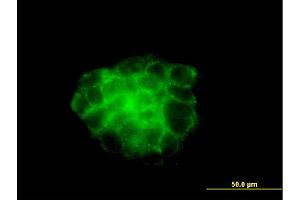 Immunofluorescence of monoclonal antibody to KRT4 on A-431 cell. (KRT4 抗体  (AA 194-300))