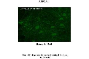 Sample Type :  Rhesus macaque spinal cord  Primary Antibody Dilution :  1:300  Secondary Antibody :  Donkey anti Rabbit 488  Secondary Antibody Dilution :  1:500  Color/Signal Descriptions :  Green: ATP2A1  Gene Name :  ATP2A1  Submitted by :  Timur Mavlyutov, Ph. (ATP2A1/SERCA1 抗体  (N-Term))