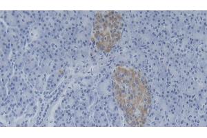 Detection of NMES1 in Human Pancreas Tissue using Polyclonal Antibody to Normal Mucosa Of Esophagus Specific 1 (NMES1) (NMES1 抗体  (AA 1-83))