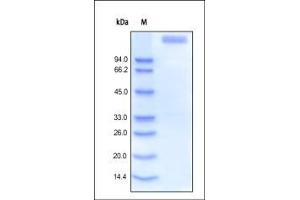 SDS-PAGE (SDS) image for Leptin Receptor (LEPR) (AA 22-839) protein (Fc Tag) (ABIN2181459)