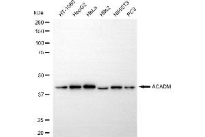Western blotting analysis using ACADM antibody (ABIN7799351). (Recombinant Medium-Chain Specific Acyl-CoA Dehydrogenase, Mitochondrial (MCAD) 抗体)
