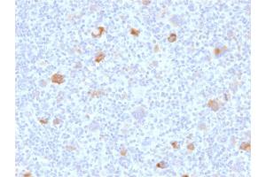 Immunohistochemistry (IHC) image for anti-BCL2-Like 1 (BCL2L1) (AA 1-135) antibody (ABIN6940516) (BCL2L1 抗体  (AA 1-135))