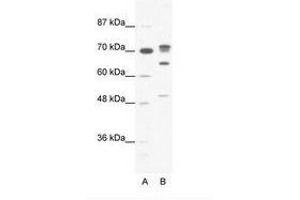 Image no. 1 for anti-DEAD (Asp-Glu-Ala-Asp) Box Polypeptide 21 (DDX21) (N-Term) antibody (ABIN6736053) (DDX21 抗体  (N-Term))